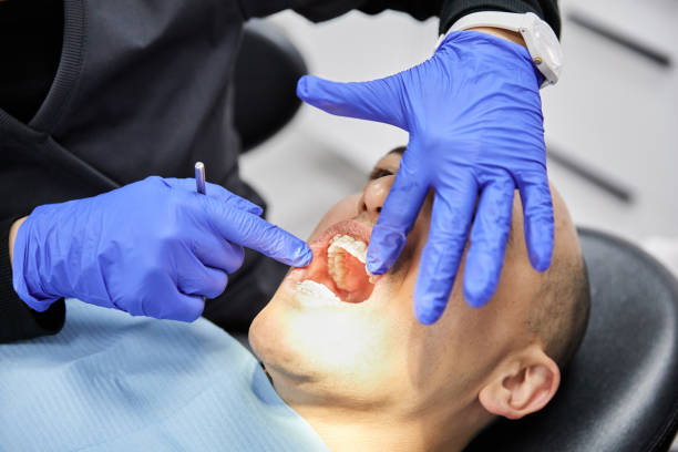 Best Emergency Wisdom Teeth Removal in Laurence Harbor, NJ